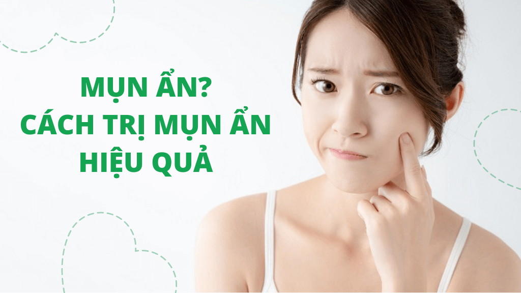 Tất tần tật về mụn ẩn và cách trị mụn ẩn hiệu quả